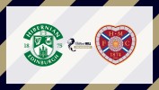Hibernian vs Heart of Midlothian thumbnail artwork