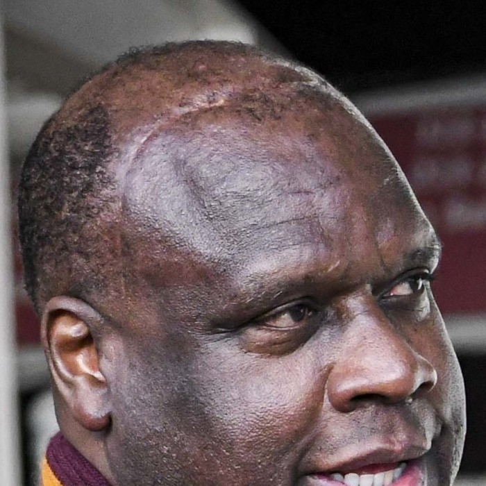 Dexter Manley